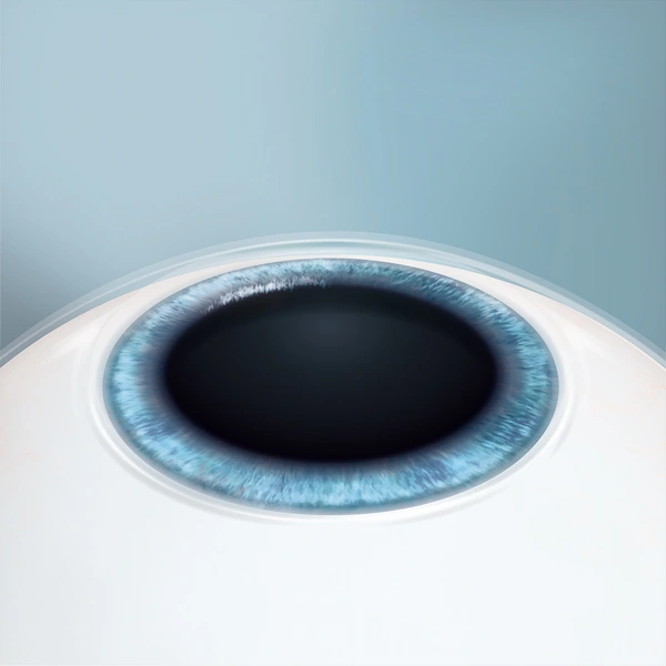 silk lasik surgery