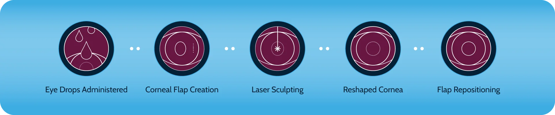 LASIK Surgery in Ahmedabad