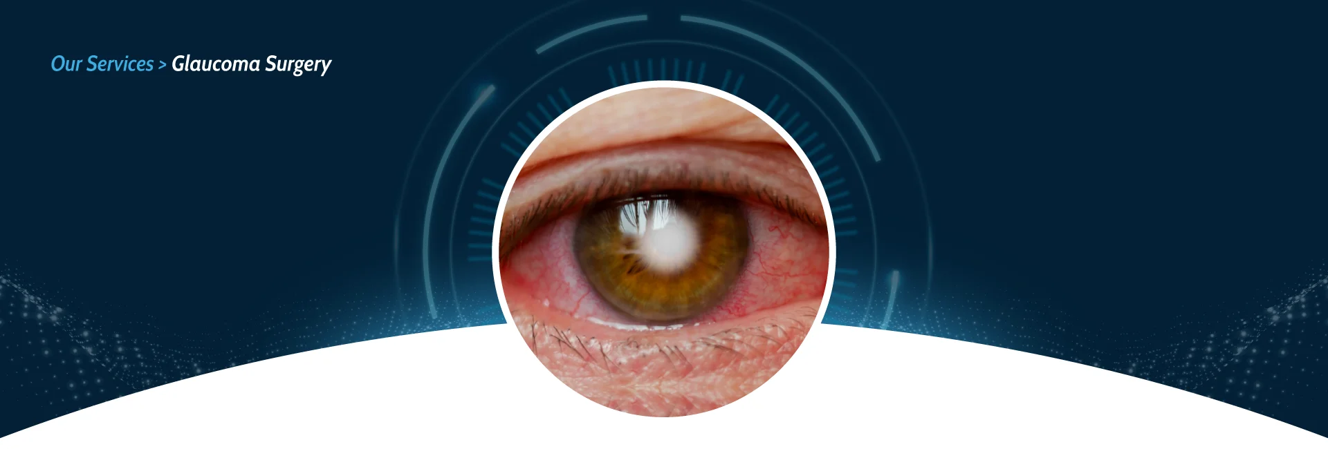 Glaucoma Treatment in ahemdabad