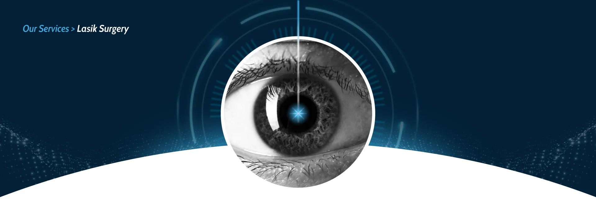 LASIK Surgery